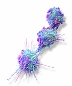 Ovarian cancer cells,SEM