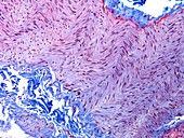Peripheral nerve,light micrograph