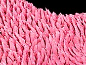 Tongue surface,SEM