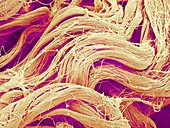 Collagen fibres,SEM