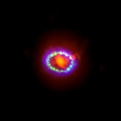 Supernova 1987A remnant,composite