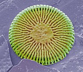 Diatom,SEM