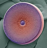 Diatom,SEM