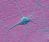 Motor neurone,SEM