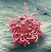 Lymphoma cancer cell,SEM