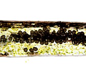 Hornwort sporocytes,light micrograph