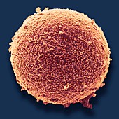Immature germ cell in semen,SEM