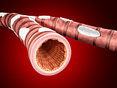 Illustration of bronchial epithelium