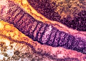 Lung mitochondrion,TEM