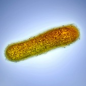 Cholera bacterium,TEM