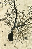 Purkinje nerves cell,light micrograph