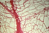Peritoneal blood vessels,micrograph