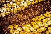 Artery and fat cells,light micrograph