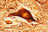 Spinal cord neurone,light micrograph