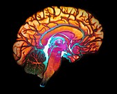 Human brain,3D MRI scan