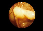 Maxillary sinus and dental roots