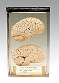 Chimpanzee brain,specimen