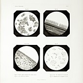First ever photomicrographs,1845