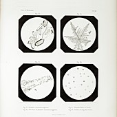 First ever photomicrographs,1845