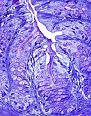 Large bowel glands,light micrograph