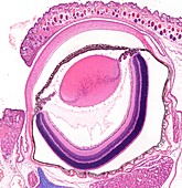 Fetal eye,light micrograph