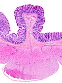 Large bowel,light micrograph