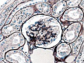 Glomerulus,light micrograph