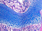 Epiphyseal growth plate,light micrograph