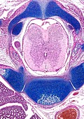Fetal spine,light micrograph