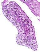 Foetal ovary,light micrograph