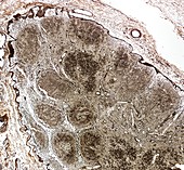Lymph node,light micrograph