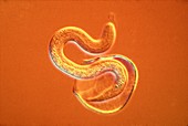 Roundworm hatching,light micrograph