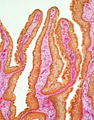 Nasal papilloma,light micrograph
