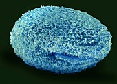 Isotricha ciliate protozoan,SEM