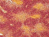 Canine parvovirus,Light micrograph