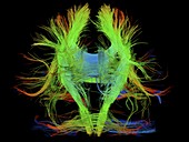 White matter fibres of the human brain