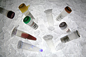 Cancer research samples