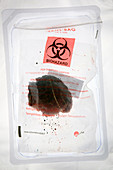Tissue sample in biohazard bag