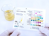 Urine home test kit