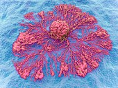Cancer cell spreading,illustration