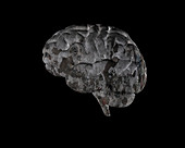 Brain disease,conceptual image