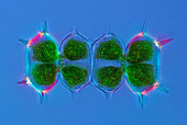 Xanthidium desmid,micrograph