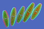 Netrium desmids,light micrograph