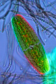 Desmid and Cyanobacteria,micrograph