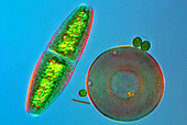 Desmid and amoeba,light micrograph