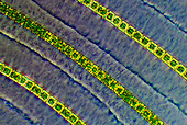 Hyalotheca desmids,light micrograph