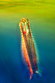 Gastrotrich,light micrograph