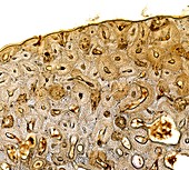 Bone,light micrograph