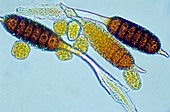 Rose spot fungus spores,light micrograph