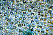Mushroom spores,light micrograph